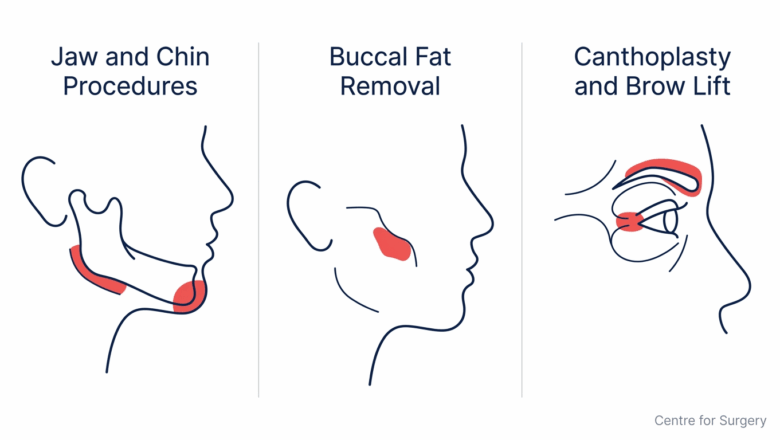 Diagram showing common looksmaxxing aesthetic goals mapped to their safe regulated surgical equivalents including jaw and chin procedures, buccal fat removal, and canthoplasty