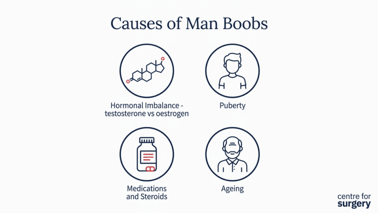 Diagram showing the four main causes of man boobs: hormonal imbalance, puberty, medications and steroids, ageing