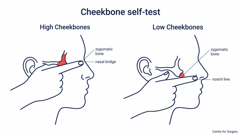 Diagram showing how to test whether you have high or low cheekbones by feeling where your zygomatic bone meets the level of your nose bridge versus your nostrils