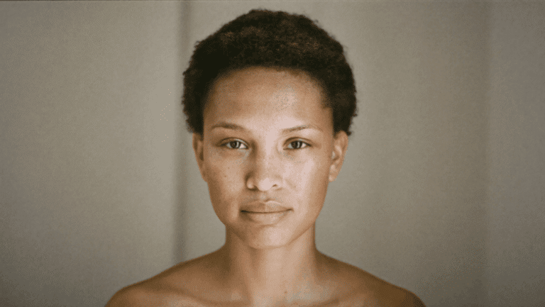 Woman with bare skin considering how to make her nose smaller — surgical and non-surgical options, Centre for Surgery London