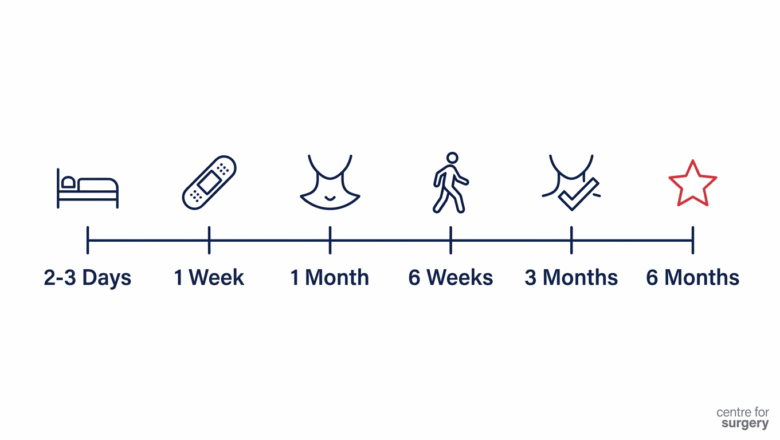 Neck lift recovery timeline diagram: 2 to 3 days, 1 week, 1 month, 6 weeks, 3 months, and 6 months for full healing, at Centre for Surgery London