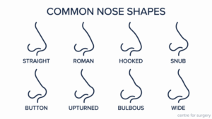 Chart of eight common nose shapes in profile — straight, Roman, hooked, snub, button, upturned, bulbous and wide, Centre for Surgery London