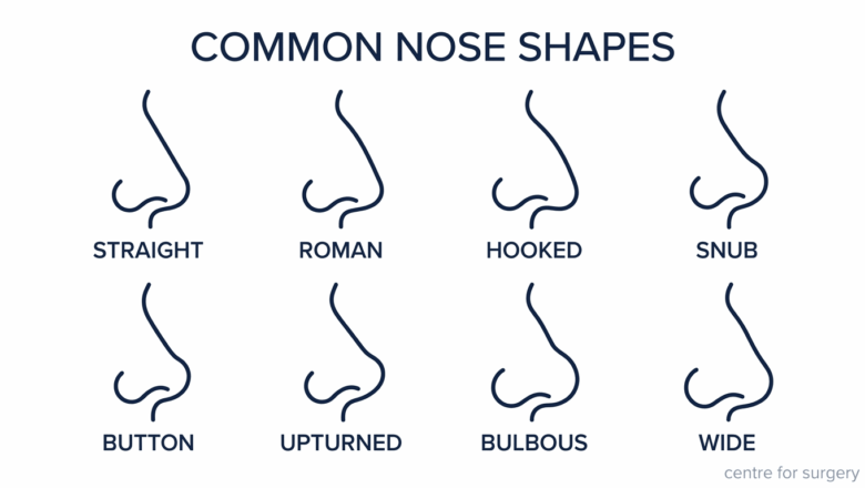 Chart of eight common nose shapes in profile: straight, Roman, hooked, snub, button, upturned, bulbous and wide, Centre for Surgery London
