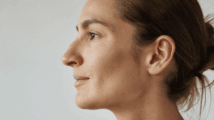 Side profile showing a short slightly upturned nose — snub nose shape, Centre for Surgery London