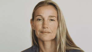 Woman in her fifties with naturally deep-set eyes — sunken eyes treatment at Centre for Surgery London
