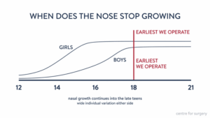 Timeline showing nasal growth completing around age 16 in girls and 17 to 18 in boys, with 18 as the earliest age for rhinoplasty, Centre for Surgery London